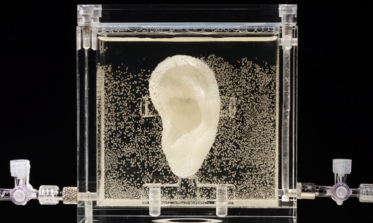 U Njemačkoj izložena "živa" replika Van Gogovog uha