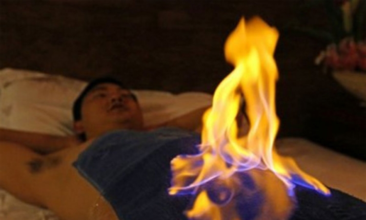 U Kini sve zastupljenija terapija vatrom