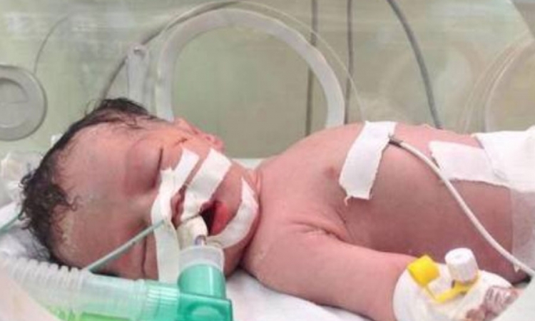 Čudo u bolnici u Gazi: Doktori spasili bebu iz tijela ubijene Palestinke