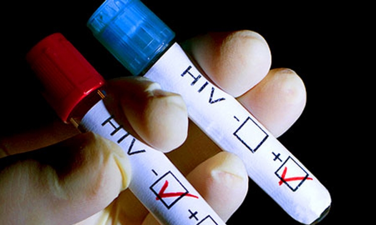 Besplatno i anonimno testiranje na HIV