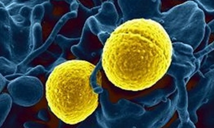 Stručnjaci upozoravaju: Superbakterija će oduzeti 10 miliona života godišnje