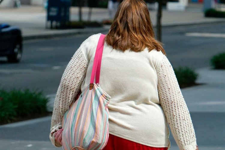Gojaznost povećava rizik od razvoja raka debelog crijeva