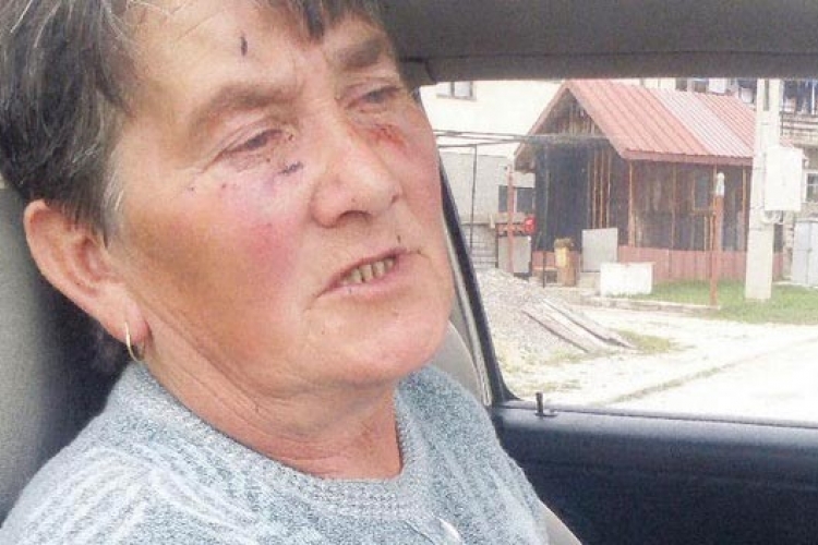 Crna Gora: Razbojnici ženu prebili pa polili benzinom tražeći pare
