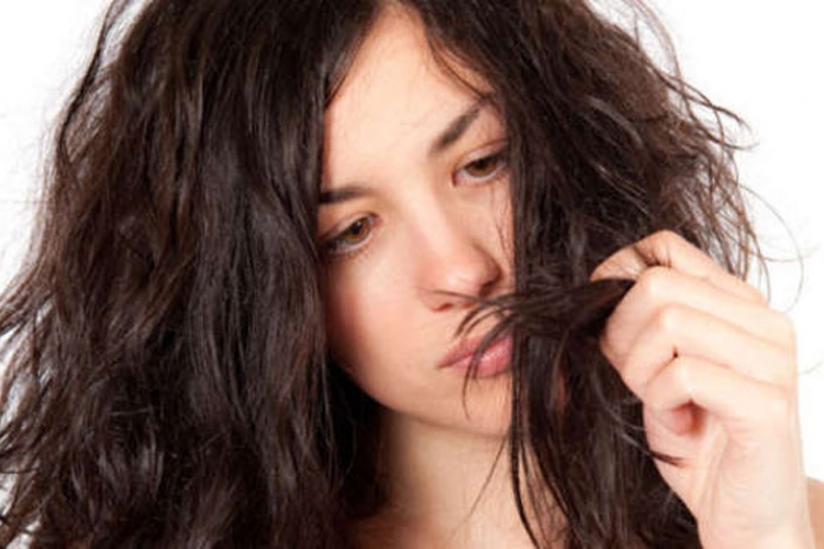 5 znakova na kosi koji otkrivaju zdravstvene probleme