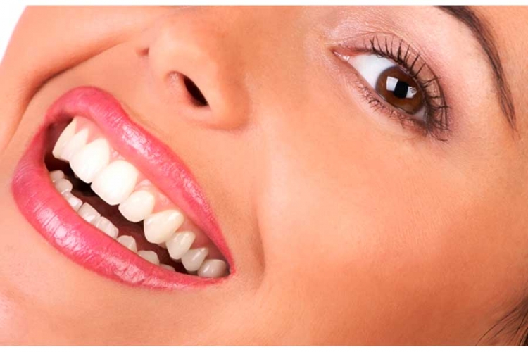 5 načina da uklonite zubni kamenac kod kuće