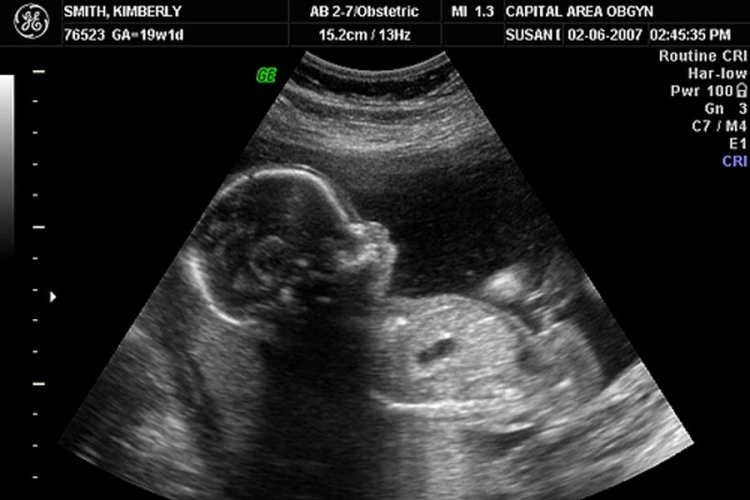Naučnici razvijaju ljudski fetus van materice