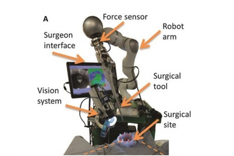 Robot zašiva pacijente bolje od hirurga
