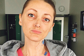 Dona Ares nakon operacije: Zbog bolesti nema više muzičke karijere