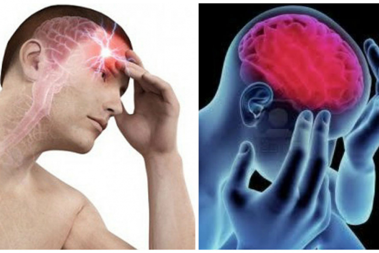 Migrena povezana s bakterijama