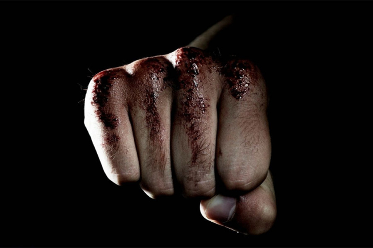 Porodično nasilje u Doboju: Supruga udarila tašnom, a svekrvu šakom