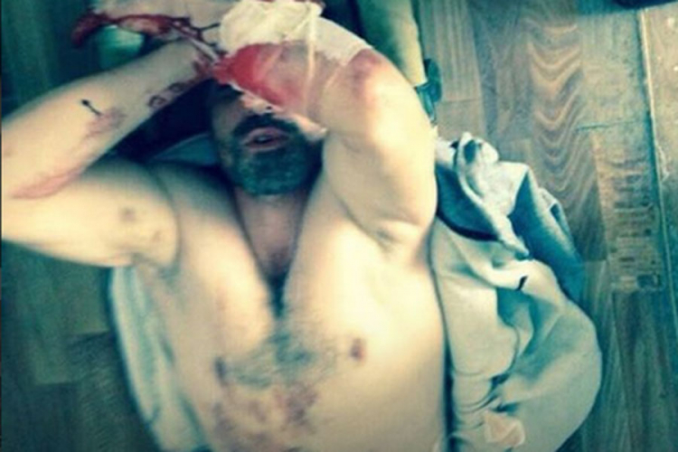 Ruski MMA borac sam sebi isjekao stomak u zatvoru u znak protesta