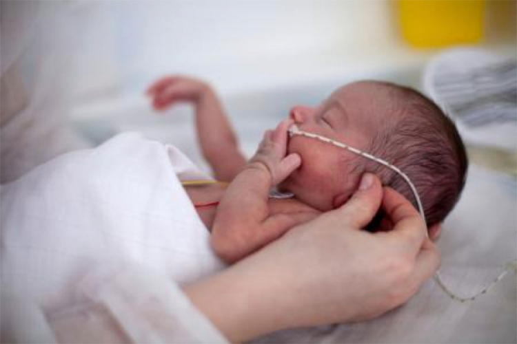 Rođena najmanja beba u Srbiji - imala je samo 350 g