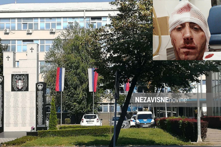 Dosadašnja istraga pokazuje da su napadači htjeli ubiti Kovačevića