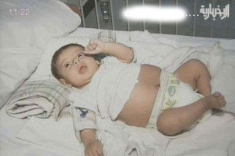 Ljekari otkrili da je beba koja se rodila prije 30 dana "trudna"