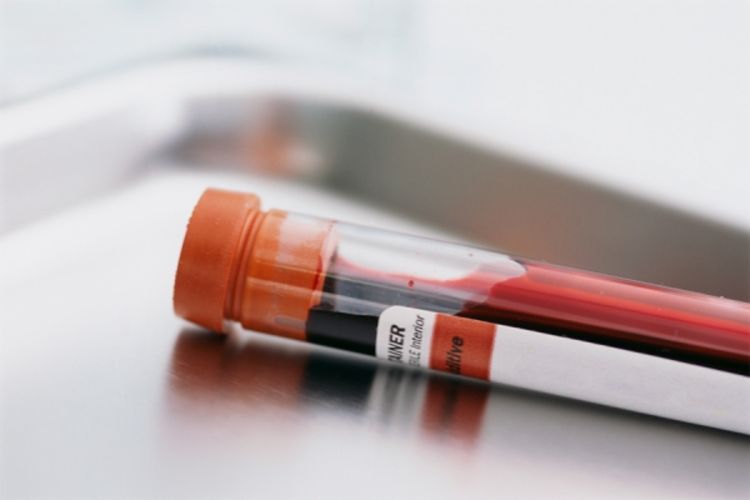 Rusi pronašli bolji način za analizu krvi