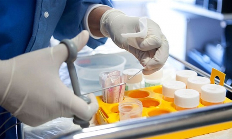 Jednostavnim testom krvi biće moguće utvrditi 13 različitih vrsta raka