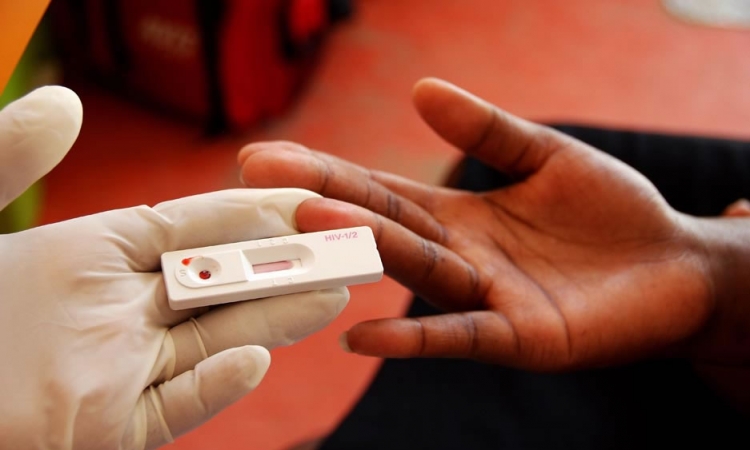 Od posljedica HIV-a umrlo 36 miliona ljudi