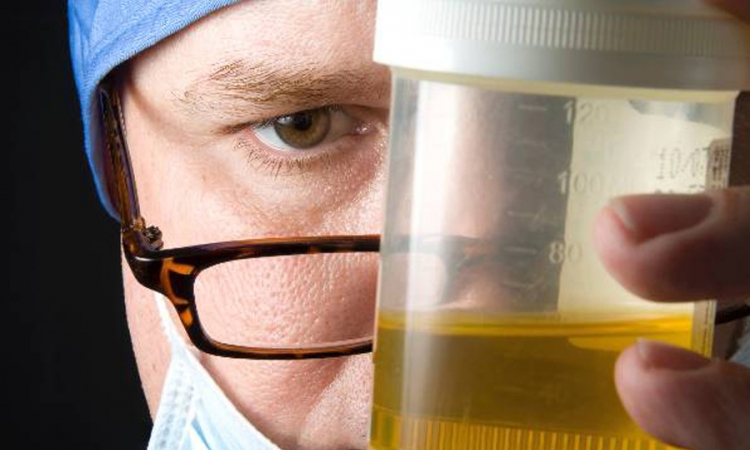 Test urina otkriva virus