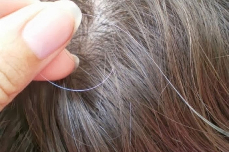 Ovako možete ukloniti sijede dlake pomoću samo jednog sastojka (VIDEO)