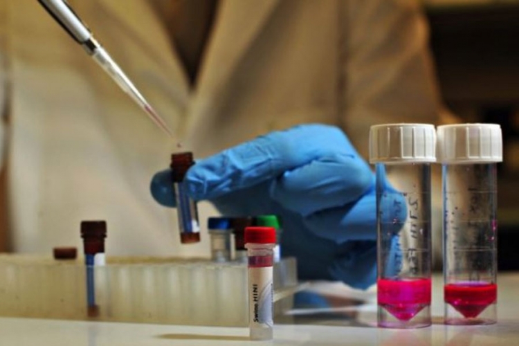 Ruski naučnici otkrili vakcinu protiv raka