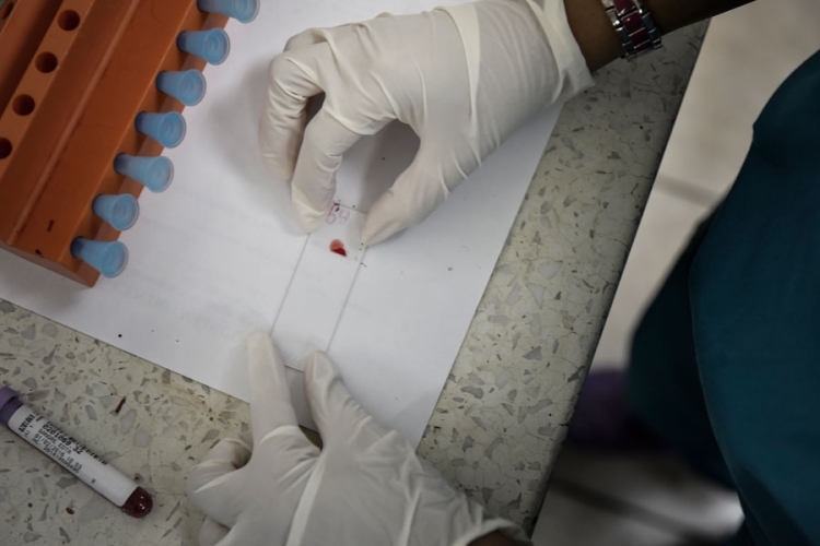 Francuska ograničila transfuziju krvi zbog virusa zika