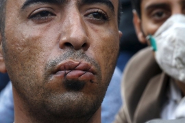 Kale:Iranci zašili usta u znak protesta
