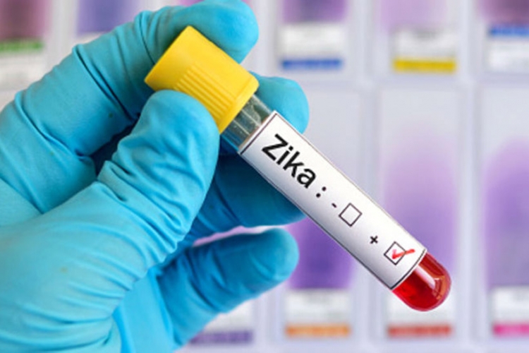Hrvatica u Brazilu zaražena zika virusom