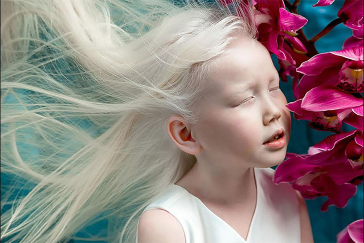 Sibirska kraljica: Albino djevojčica nova internet senzacija