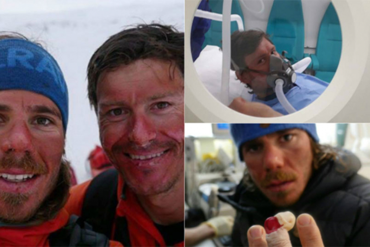 Ivica Kostelić zadobio promrzline na Grenlandu