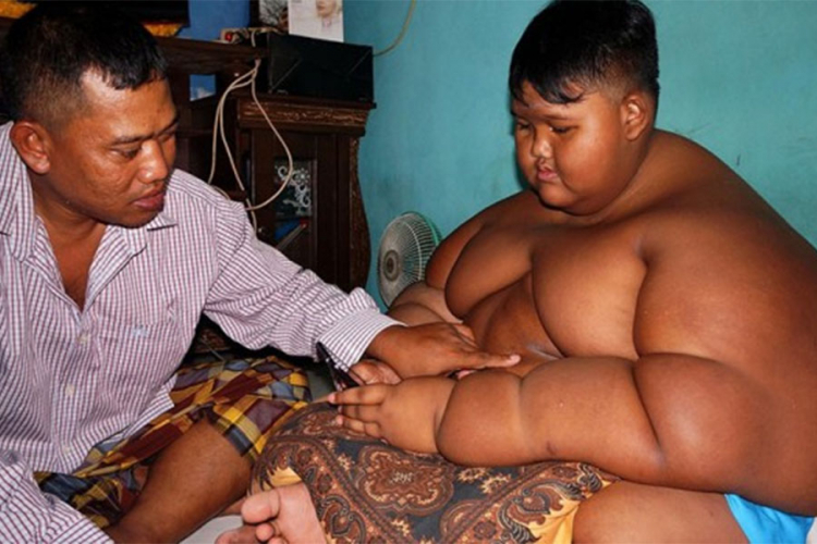 Indonežanin ima 10 godina i skoro 200 kilograma