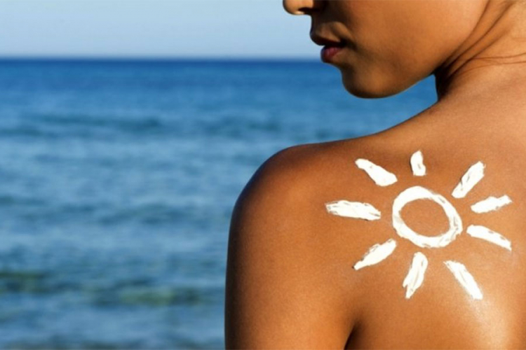 15 stvari koje treba da uradite kada izgorite na suncu