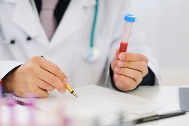 Dijagnostički testovi za hepatitis B, C i HIV u BiH više ne postoje