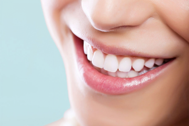 Koje namirnice uzrokuju žute zube?