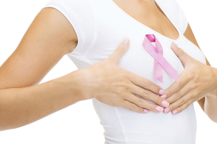 Skrining mamografija najbolje rješenje za prevenciju karcinoma dojke