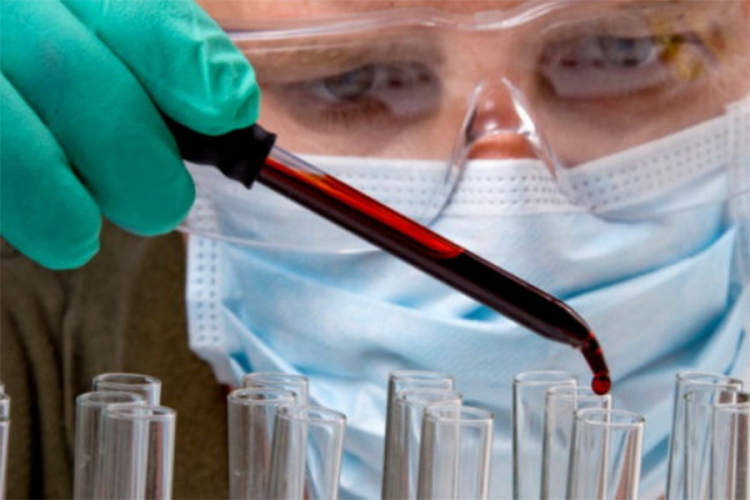 BBC: Naučnici korak bliže univerzalnom testu krvi za otkrivanje raka