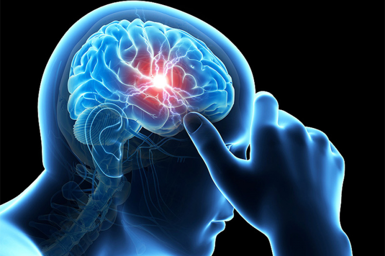 Samo jedan potres mozga dovoljan za Parkinsonovu bolest