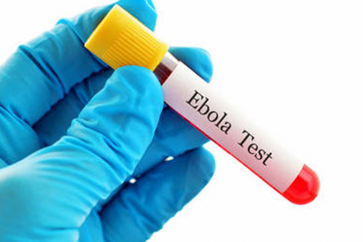 Povećan nivo opasnosti od ebole