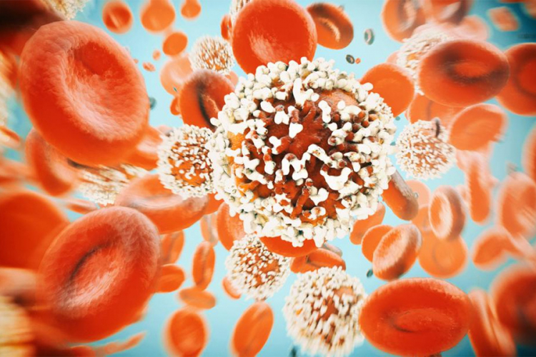 Novi test krvi detektuje rak godinama prije pojave bolesti
