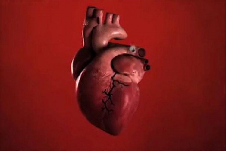 Šokantan video: Evo šta cigarete rade vašem srcu