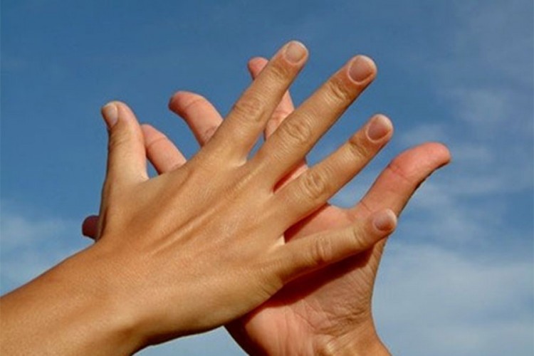 Zašto vam se znoje ruke kada ste nervozni?