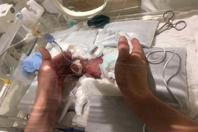Čudo od bebe: Rođen sa 268 grama, napustio bolnicu zdrav sa 3.238 kilograma