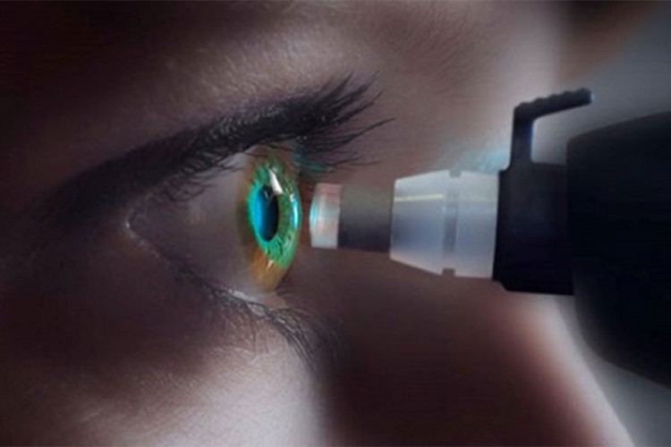 Besplatno mjerenje očnog pritiska 14. marta u UKC RS