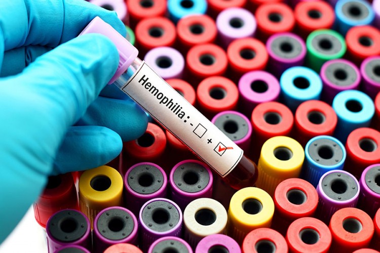 Širom BiH obilježen Svjetski dan borbe protiv hemofilije