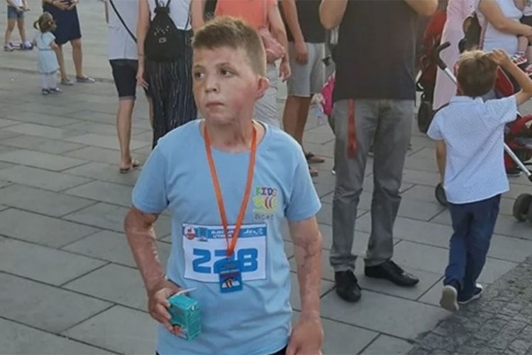 Mali heroj: Preživio stravičan požar pa istrčao trku u Tuzli