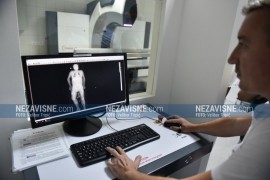 U UKC RS stigao rendgen aparat koji snima kompletan skelet pacijenta