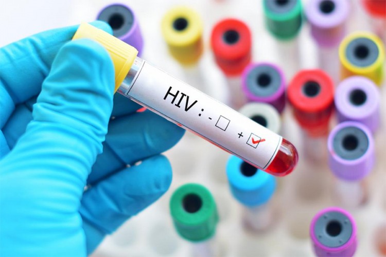 Pojavio se novi soj virusa HIV