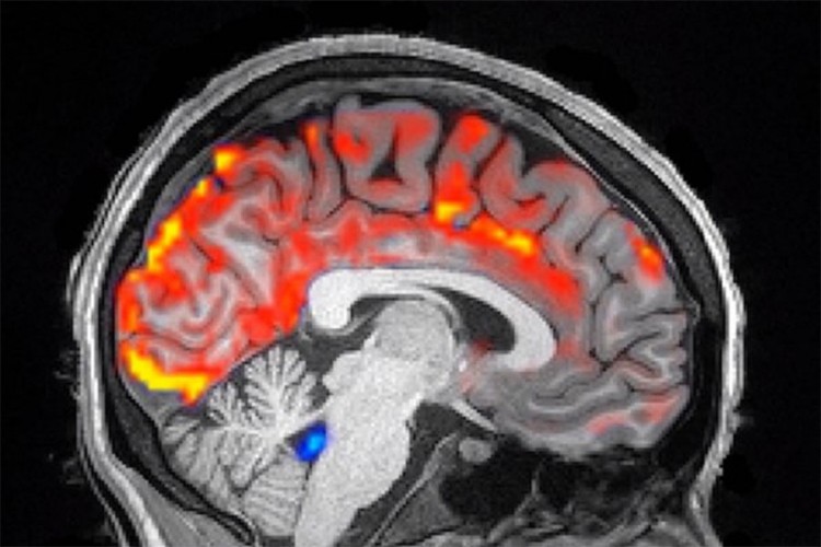 Kako izgleda pravo ispiranje mozga?