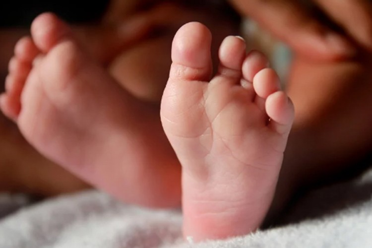 Doktori šokirani: Rođena beba sa dvije glave i tri ruke