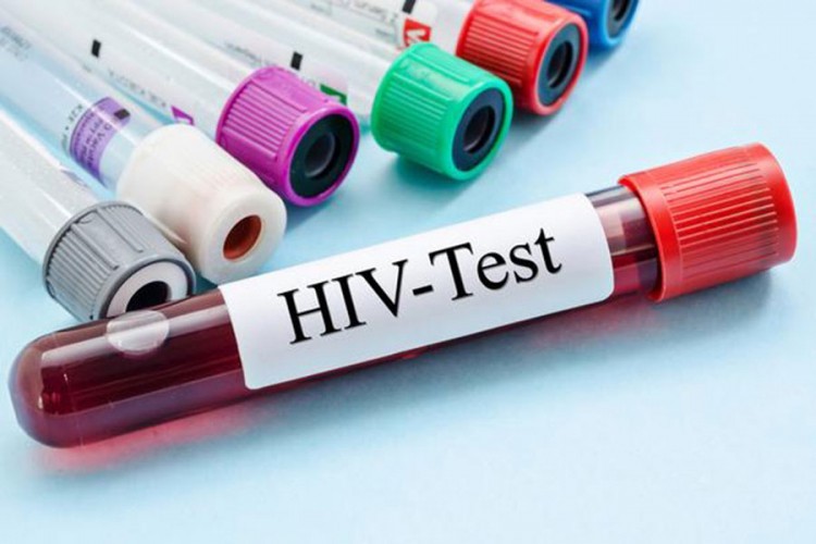 Bijelci imaju sedam puta veće šanse za prevenciju HIV-a