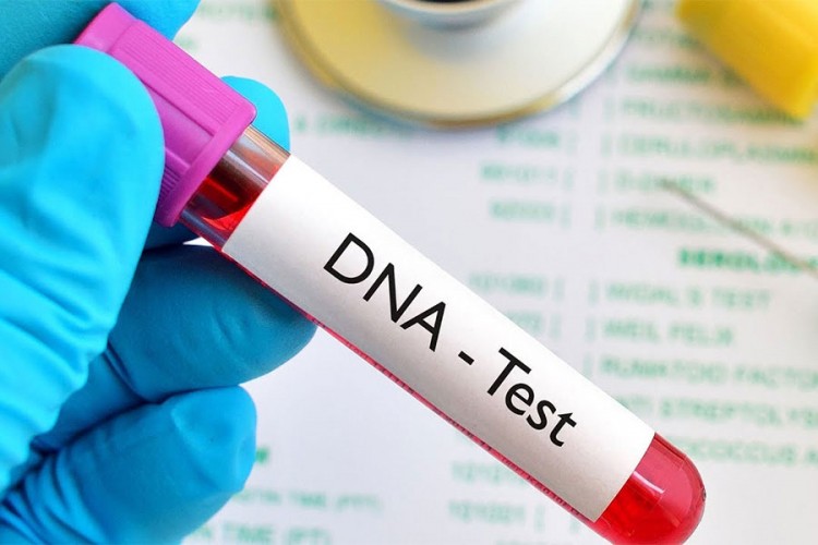 Momku kupila DNK test pa otkrila mračnu porodičnu tajnu